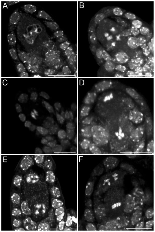 Female meiosis in the <i>tam-2</i> mutant.