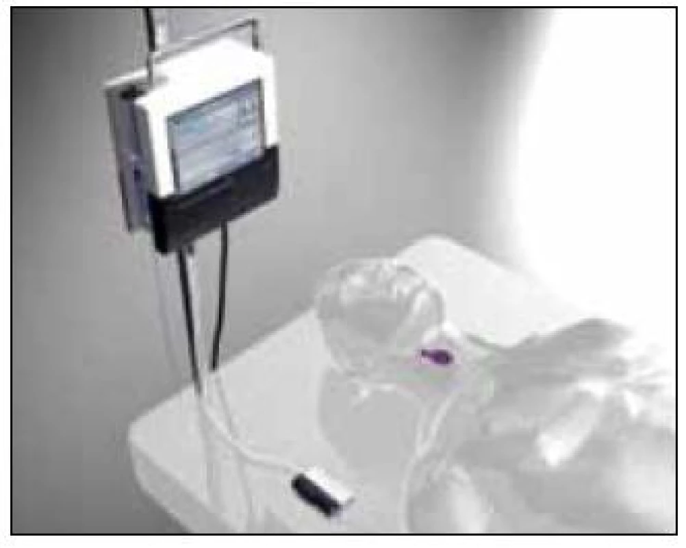 Systém Eirus<sup>TM</sup> od firmy CMA Microdialysis ke kontinuálnímu sledování glykemie a laktatemie na JIP. Sonda je zavedena cestou centrálního žilního katétru (zdroj: www.microdialysis.se).