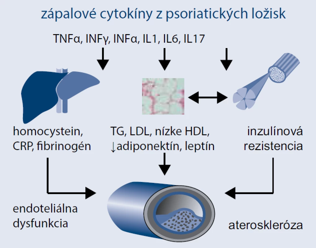 Systémový vplyv psoriatických prozápalových cytokínov. Upravené podľa [8]