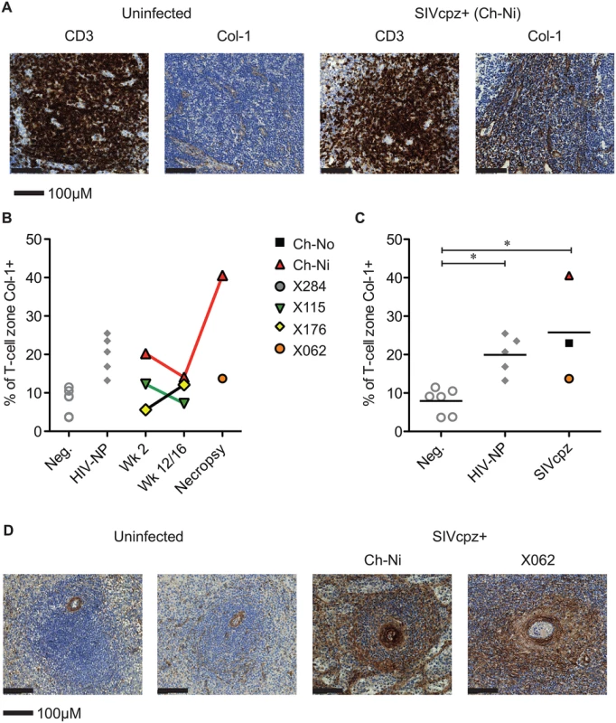 Collagen deposition in SIVcpz infected animals.