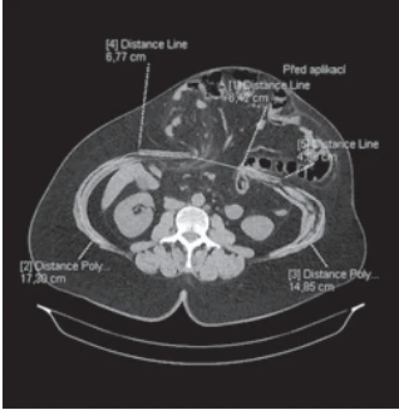  / Fig. 3.