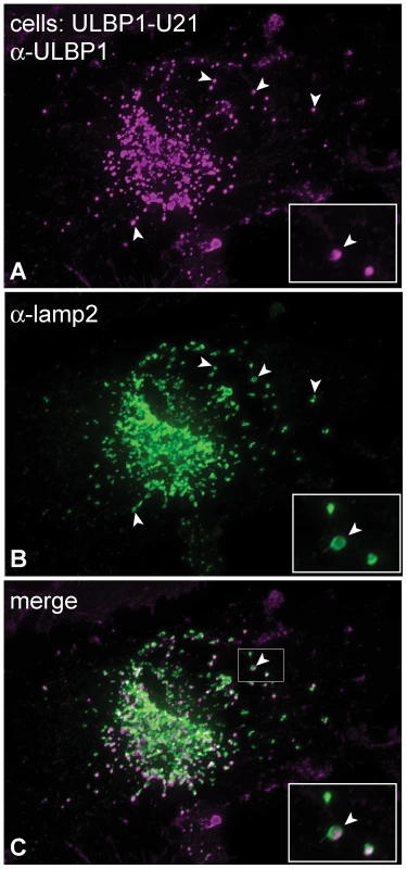 ULBP1 colocalizes with the lysosomal marker lamp2.