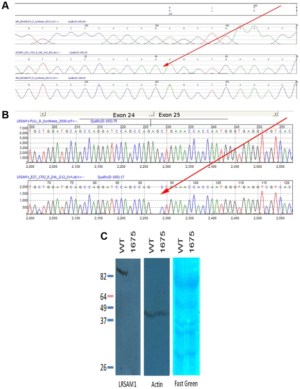 Sequence showing mutation in genomic and cDNA of affected patient.