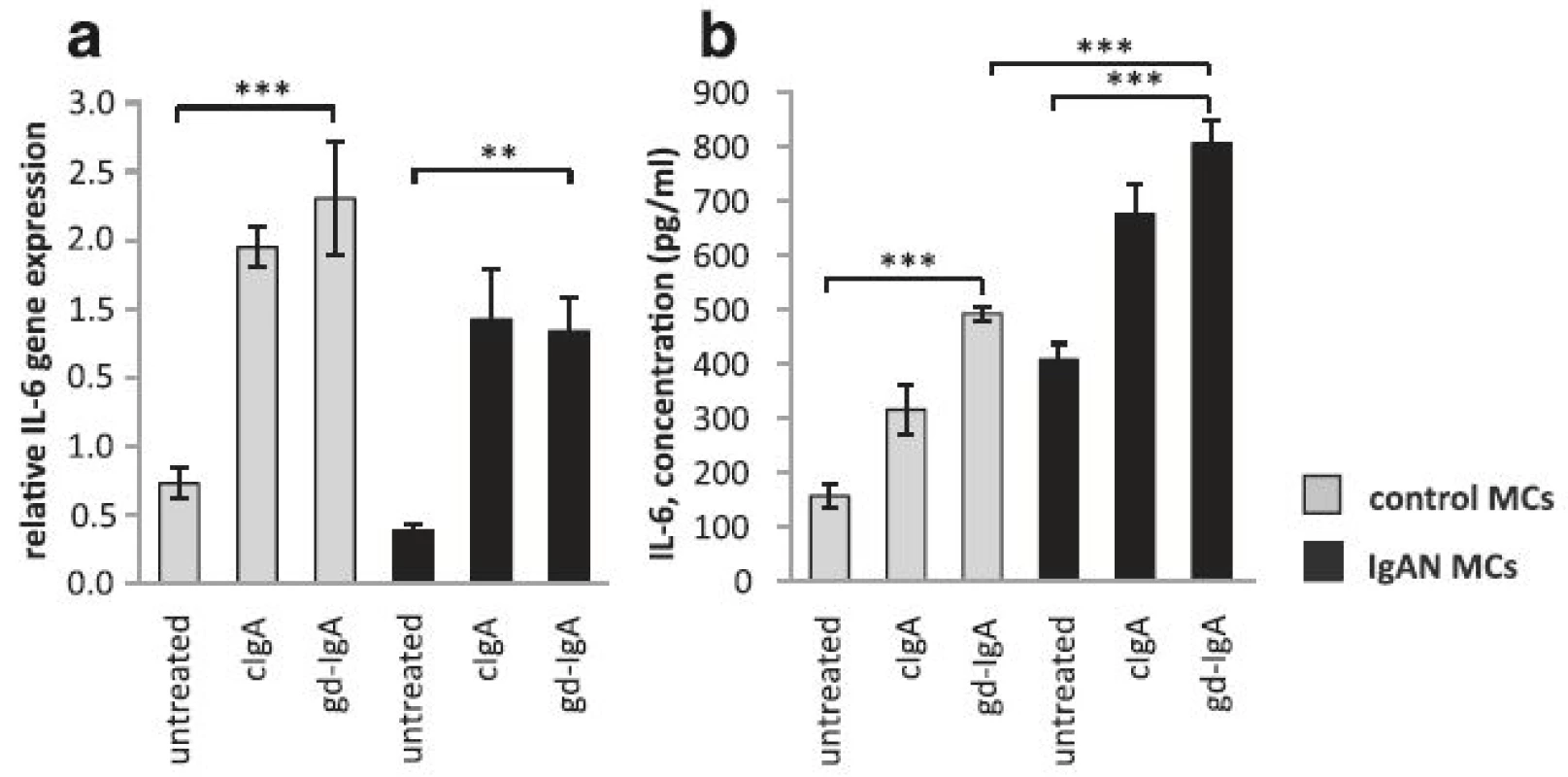 Gene expression and release of IL-6. IL-6 expression is known to increase in mesangial cells when stimulated with gd-IgA and has been suggested as a prognostic marker for IgAN but its role is still debated. Mesangial cells (MCs) from patients with IgA nephropathy (IgAN) and controls were stimulated with IgA1 purified from blood from healthy controls (cIgA) or patients with IgAN (gd-IgA) or medium only for 6 h and the gene expression was investigated. Stimulation with IgA on both controls MCs and IgAN MCs increased the gene expression of IL-6 in a similar pattern (a). The release of IL-6 into the medium after 24 h of stimulation was most pronounced for the gd-IgA treatment for both groups of cells, but the IgAN MCs released significantly more IL-6 than the control MCs stimulated with gd-IgA (b). <i>Grey bars</i> represent control MCs, <i>black bars</i> represent IgAN MCs * <i>P</i> < 0.05, ** <i>P</i> < 0.01, ***<i>P</i> < 0.001, error bars represent SEM