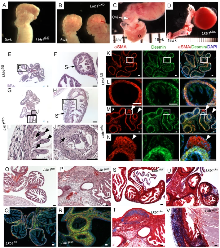 Oviductal abnormalities in <i>Lkb1<sup>cko</sup></i> mice.