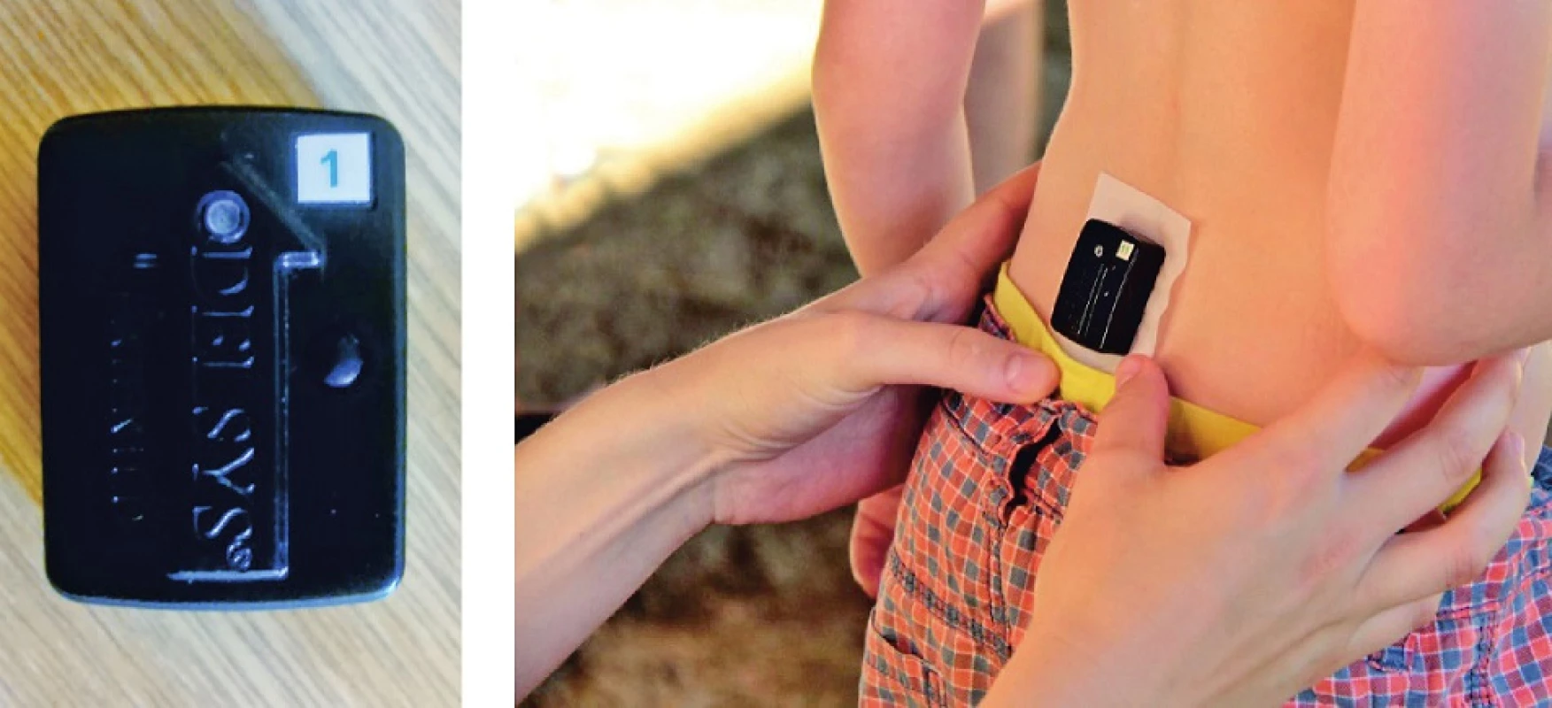 Ukázka akcelerometru Trigno wireless systém a jeho umístění na těle jezdce.
<i>(Autorka fotografií Kateřina Šušlíková, fotografie využity se souhlasem autorky.)</i>