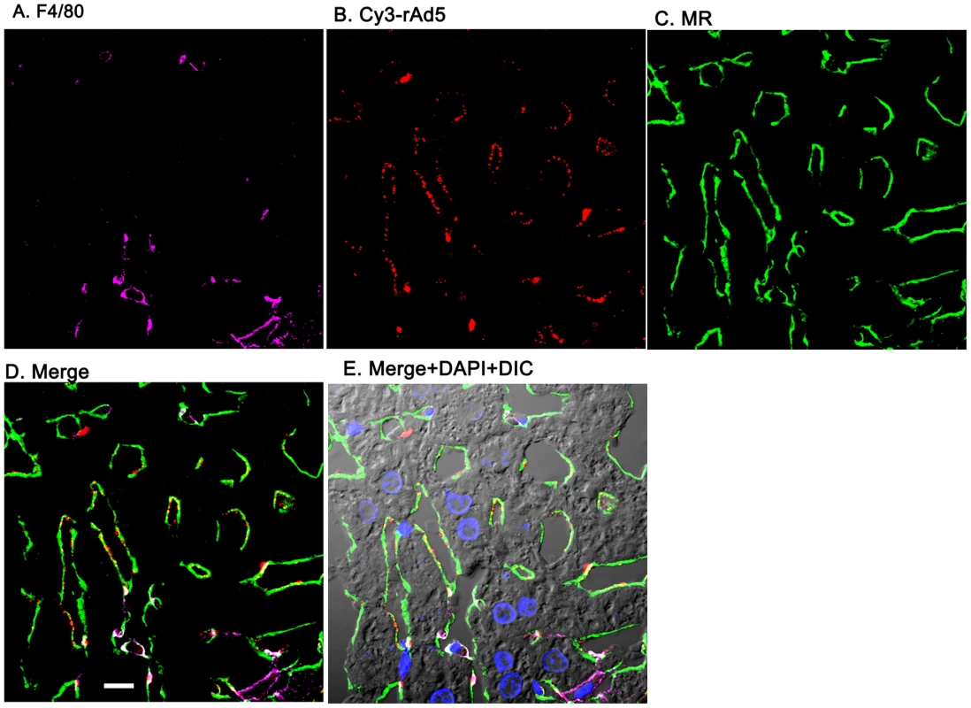 Cy3-labeled rAd5 localize predominantly to LSEC.