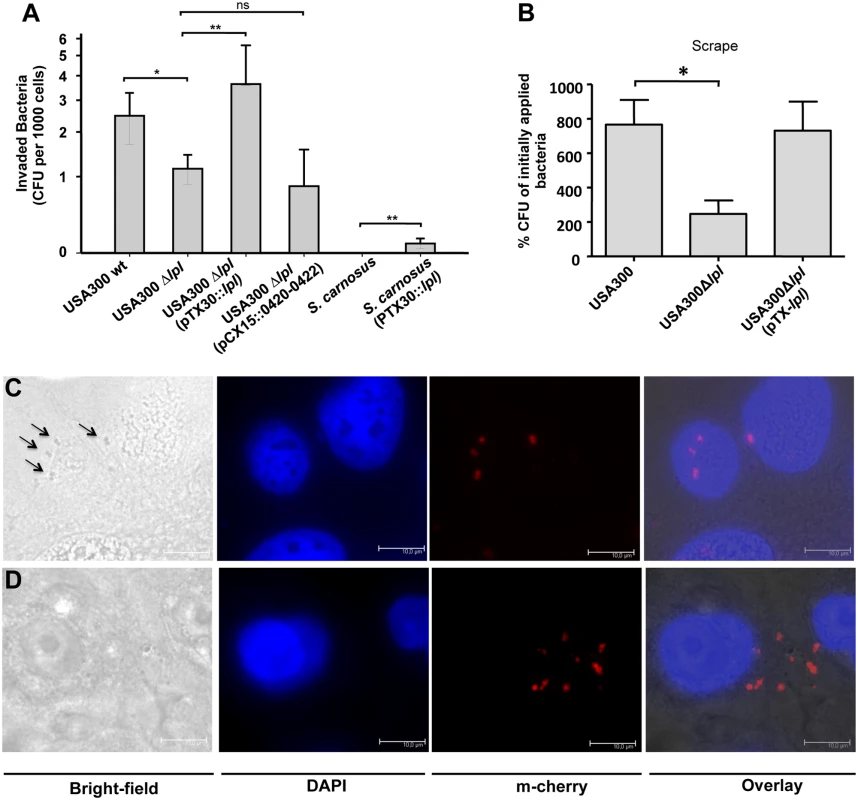 Invasion studies with human keratinocytes and mouse skin.