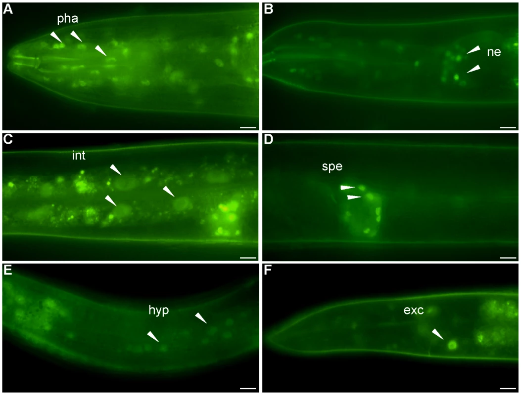 Expression pattern of <i>nhr-62</i>::<i>gfp.</i>
