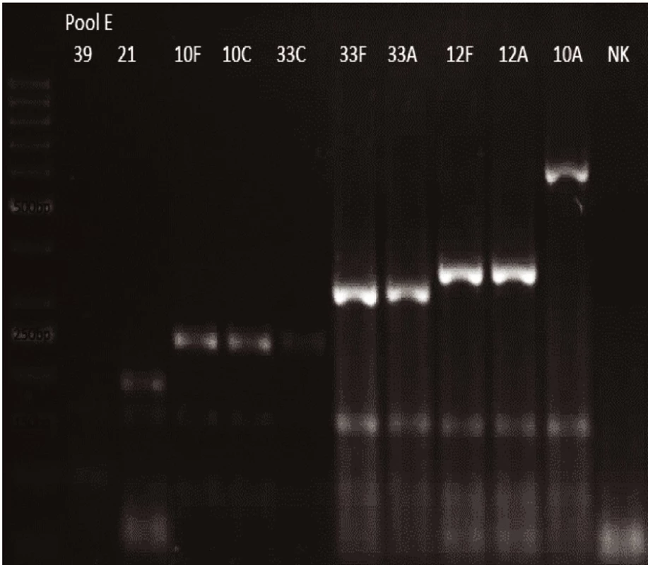 mPCR pool E
Dráha 1: 50bp DNA Ladder
Dráha 2: <i>S. pneumoniae</i> sérotyp 39 (99bp)
Dráha 3: <i>S. pneumoniae</i> sérotyp 21 (192bp)
Dráha 4: <i>S. pneumoniae</i> sérotyp 10F (248bp)
Dráha 5: <i>S. pneumoniae</i> sérotyp 10C (248bp)
Dráha 6: <i>S. pneumoniae</i> sérotyp 33C (248bp)
Dráha 7: <i>S. pneumoniae</i> sérotyp 33F (338bp)
Dráha 8: <i>S. pneumoniae</i>sérotyp 33A (338bp)
Dráha 9: <i>S. pneumoniae</i> sérotyp 12F (376bp)
Dráha 10: <i>S. pneumoniae</i> sérotyp 12A (376bp)
Dráha 11: <i>S. pneumoniae</i> sérotyp 10A (628bp)
Dráha 12: negativní kontrola
Dráha 2–11: pozitivní produkt cpsA (160bp)<br>
Fig. 5. mPCR pool E
Lane 1: 50bp DNA Ladder
Lane 2: <i>S. pneumoniae</i> serotype 39 (99bp)
Lane 3: <i>S. pneumoniae</i> serotype 21 (192bp)
Lane 4: <i>S. pneumoniae</i> serotype 10F (248bp)
Lane 5: <i>S. pneumoniae</i> serotype 10C (248bp)
Lane 6: <i>S. pneumoniae</i> serotype 33C (248bp)
Lane 7: <i>S. pneumoniae</i> serotype 33F (338bp)
Lane 8: <i>S. pneumoniae</i> serotype 33A (338bp)
Lane 9: <i>S. pneumoniae</i> serotype 12F (376bp)
Lane 10: <i>S. pneumoniae</i> serotype 12A (376bp)
Lane 11: <i>S. pneumoniae</i> serotype 10A (628bp)
Lane 12: negative control
Lanes 2–11: positive product cpsA (160bp)