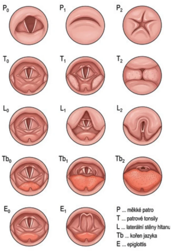 Klasifi kace dle Veera. Fig. 4. Veer classifi cation. 