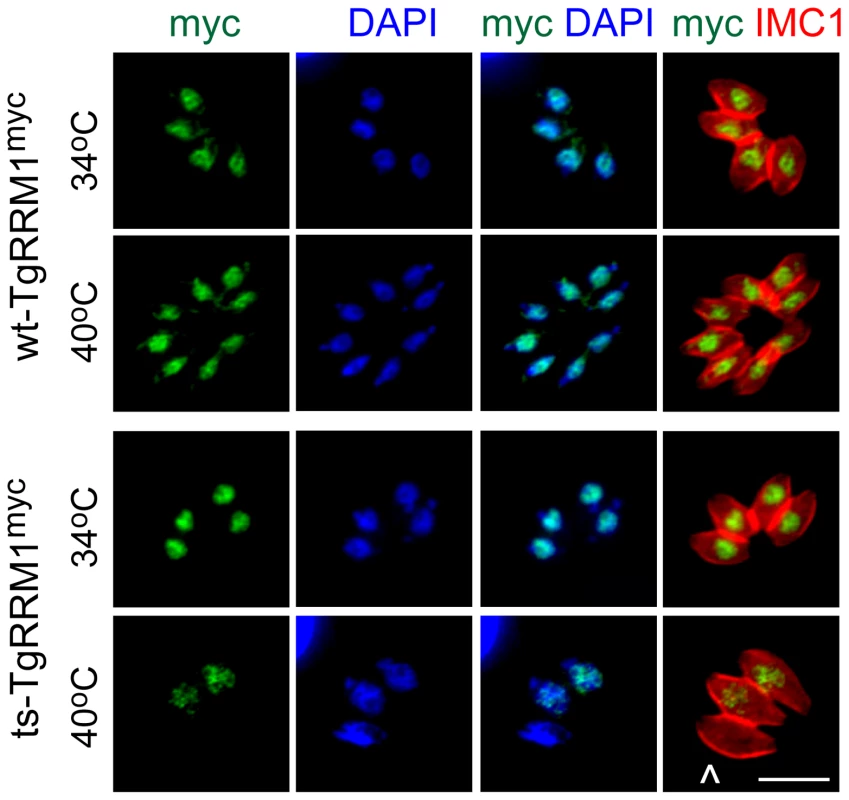Loss of TgRRM1 expression underlies the temperature lethal phenotype of mutant 12-109C6.
