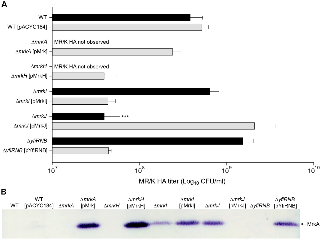 Type 3 fimbriae expression by <i>K. pneumoniae</i> AJ218.
