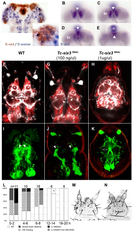 <i>Tc-six3</i> is required for central body development.