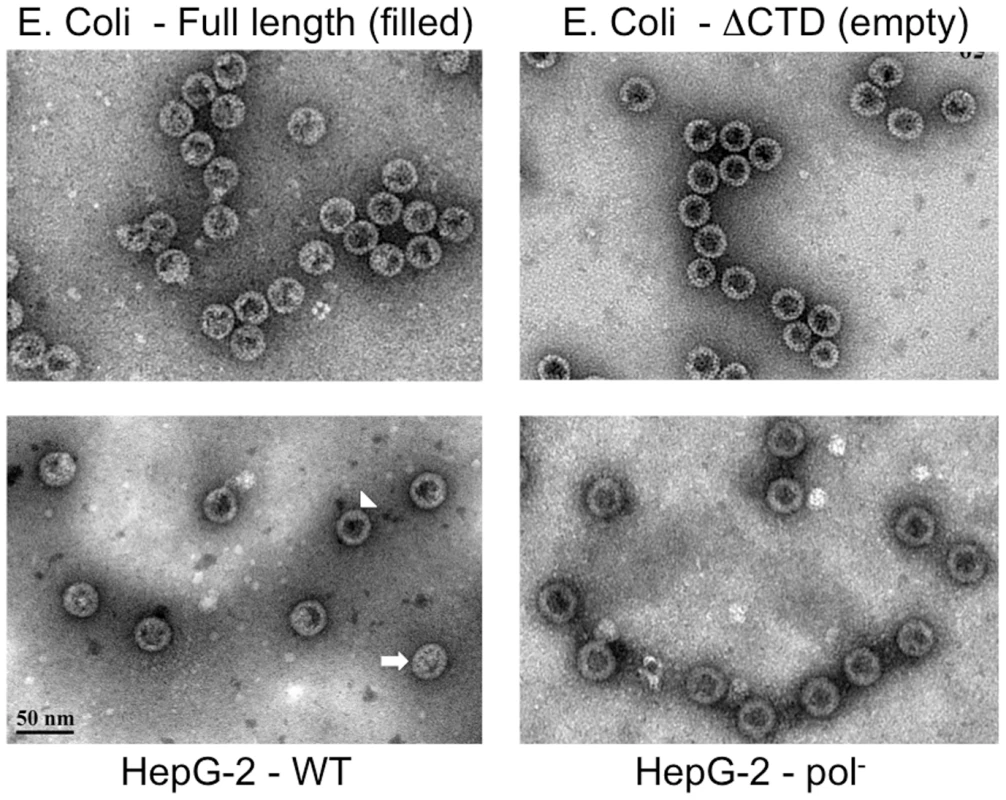 EM of intracellular capsids.