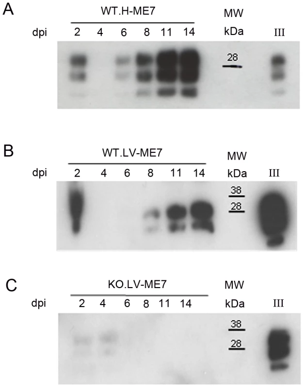 Infection of NSC during differentiation.