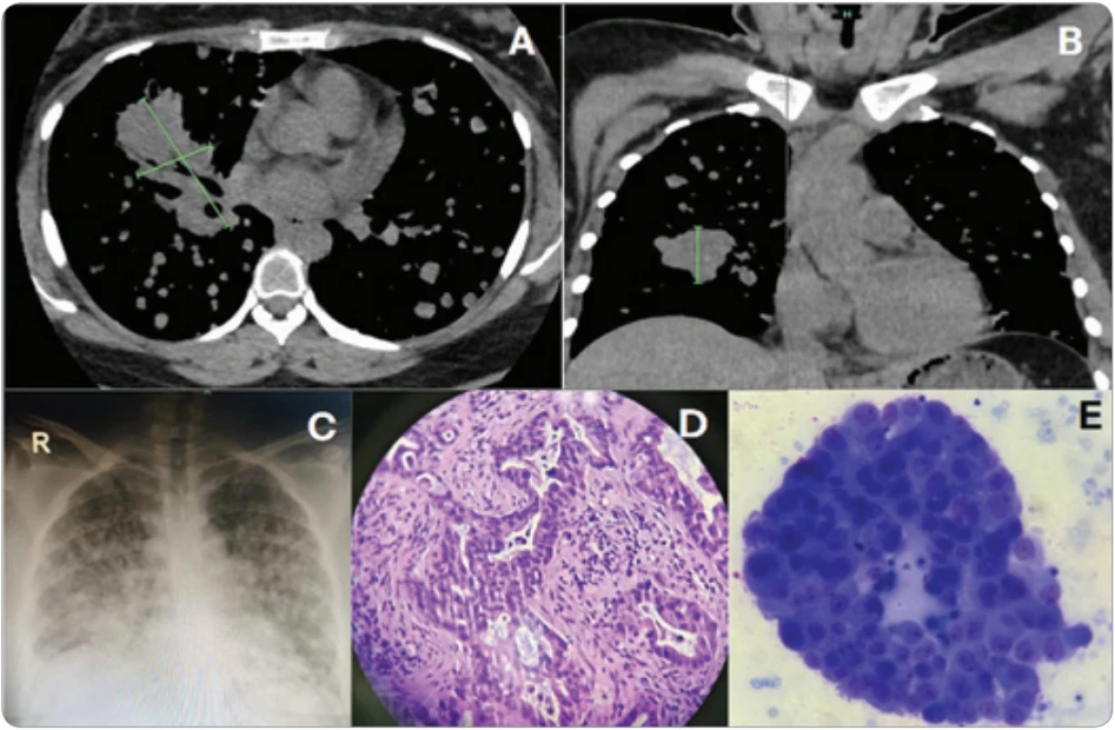 Baseline diagnostic workup. 
