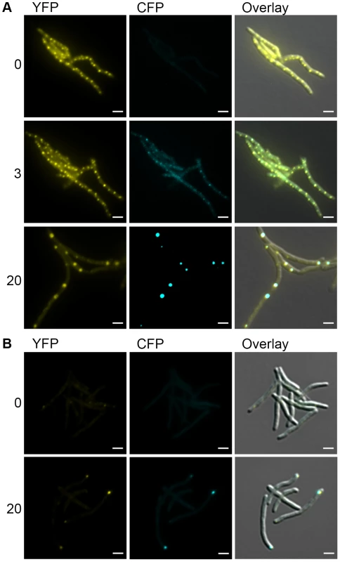 DnaK-mCitrine and ClpB-mCitrine co-localize with protein aggregates.