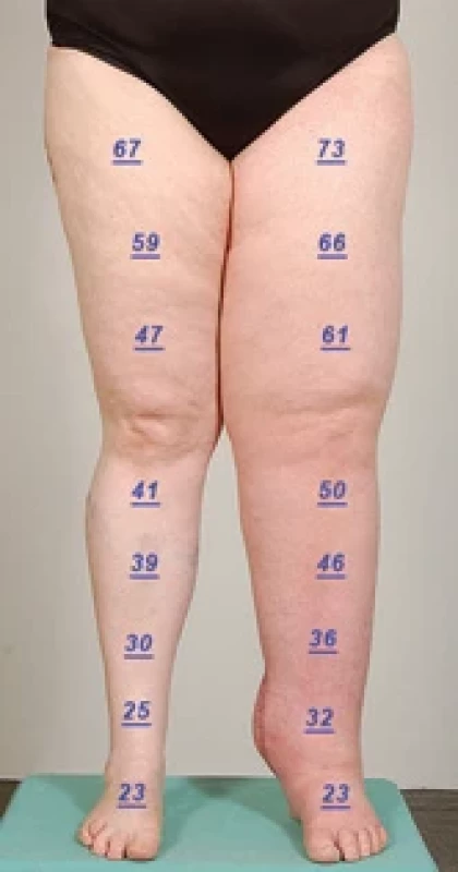 Long-term result.