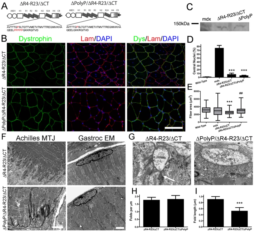 Microdystrophin<sup>ΔR4-R23/ΔCT</sup> did not cause structural abnormalities when the polyproline site was deleted from hinge 2.