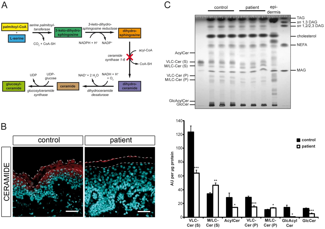 <i>In situ</i> ceramide localization and sphingolipid profile of cultured keratinocytes.