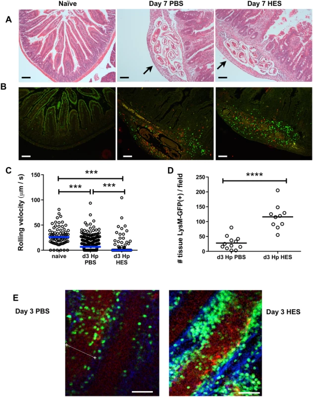 HES vaccination promotes extensive myeloid cell extravasation and accumulation around site of larval invasion.