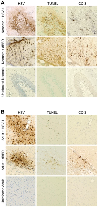 Infected regions with activated autophagy in the newborn mouse brain are associated with markers of apoptotic cell death.