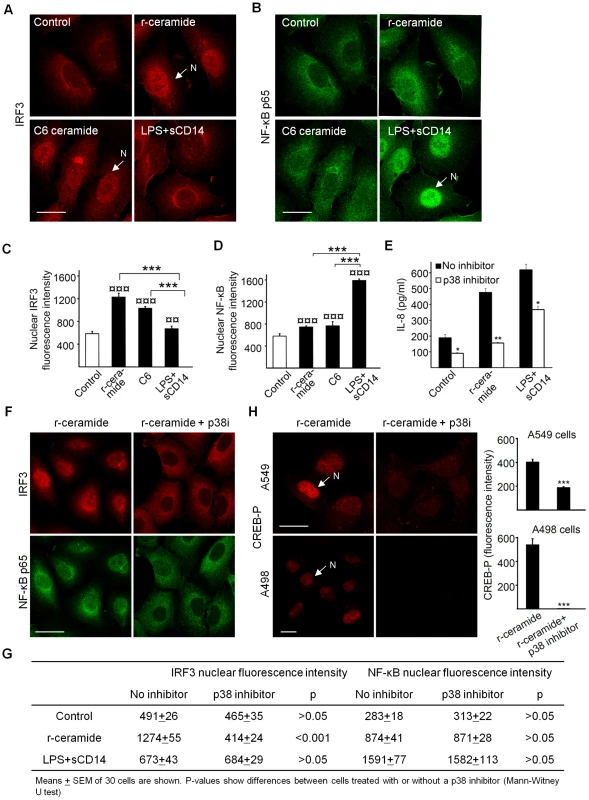Nuclear IRF3 translocation in response to ceramide/TLR4.