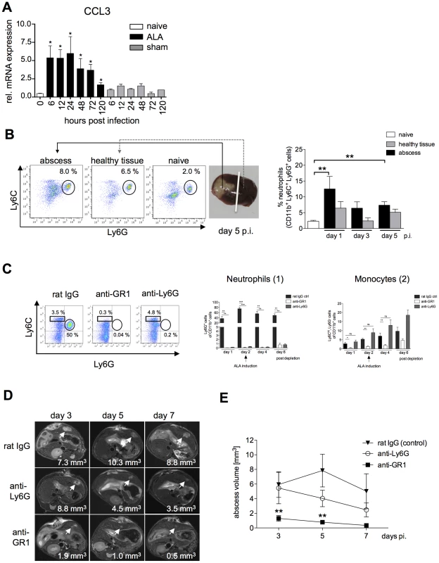 Neutrophil recruitment during ALA and effects of selective neutrophil depletion.