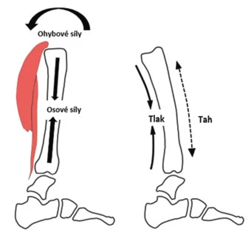 Působení tahových, tlakových a ohybových sil na tibii. Zdroj: [2].</br> Fig. 5. Application of tensile, compressive and bending forces on the tibia. Source: [2].