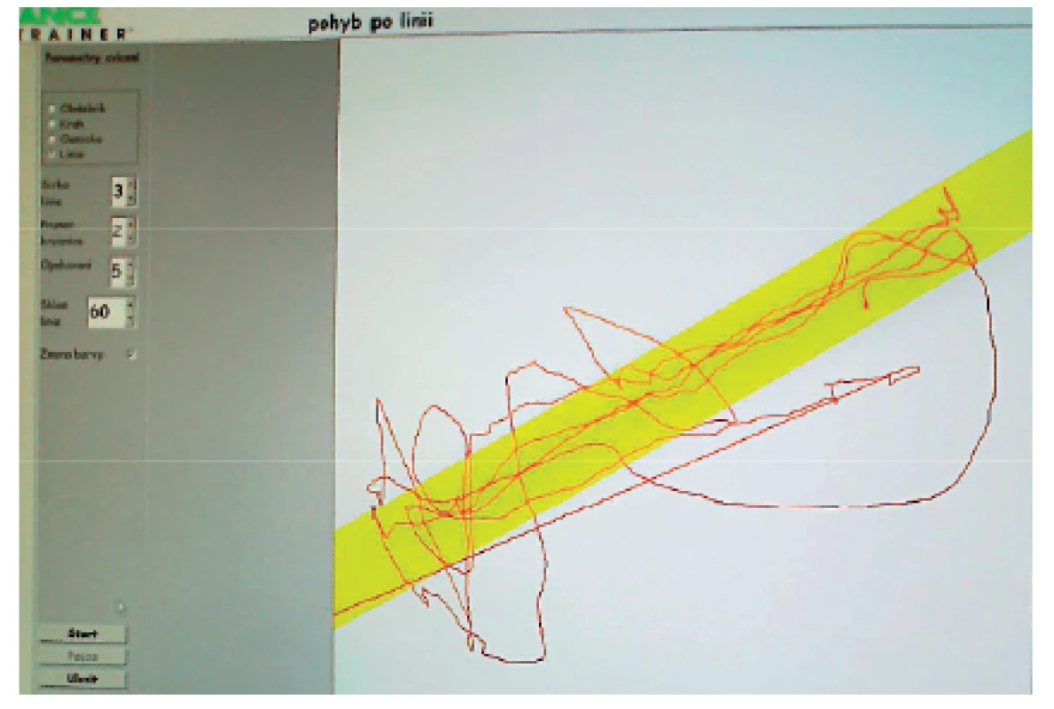 Balance Trainer – pohyb po zadané linii.
