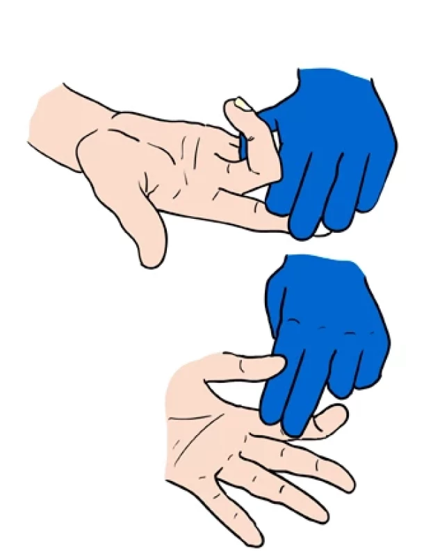 Vyšetření flexorů.
