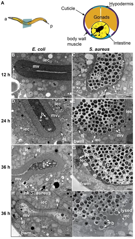 <i>S. aureus</i> causes intestinal cell effacement and lysis in <i>C. elegans</i>.