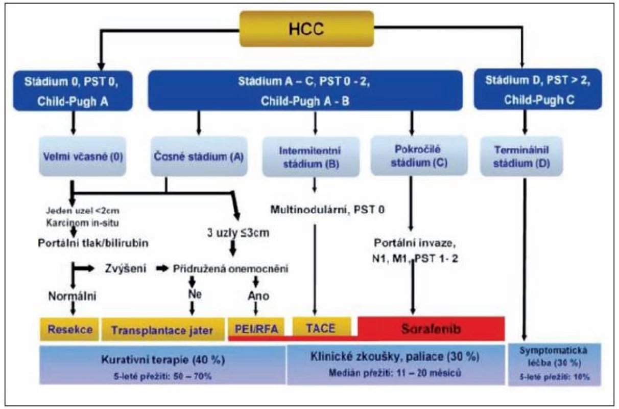 Skórovací systém BCLC (Barcelona Ckinic Liver Cancer) – rozhodující pro algoritmus terapie