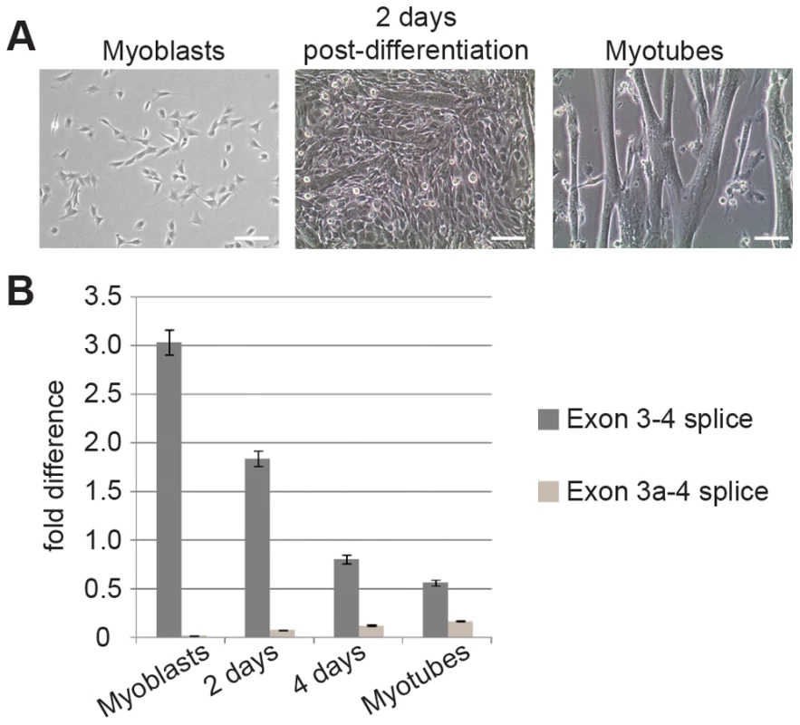 Splicing to include exon 3a is a developmentally regulated event in skeletal muscle.