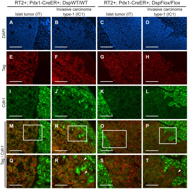 Genetic deletion of <i>desmoplakin</i> does not affect <i>cadherin 1</i> expression in <i>RT2</i> PNETs.