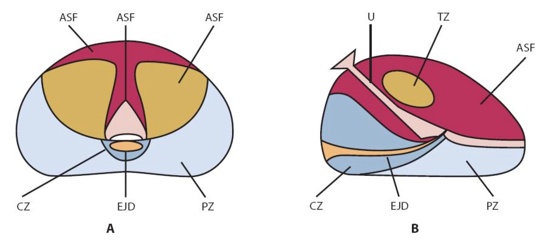 McNealovo schéma zonální anatomie prostaty (podle (17))
A – sagitální řez; B – transverzální řez. AFS – fi bromuskulární stroma , CZ – centrální zóna, EJD – ductus ejaculatorii, NVB – neurovaskulární svazek, PZ – periferní zóna, TZ – tranzicionální zóna, U – uretra
Fig. 1. McNeal scheme of the prostatic zonal anatomy (adapted from (17))
A – sagittal section; B – transversal section. AFS – anterior fi bromuscular stroma, CZ – central zone, EJD – ejaculatory ducts, PZ – peripheral zone, TZ – transitional zone, U – urethra