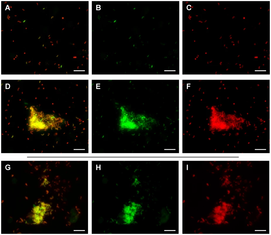 Heterogeneity of <i>tcpA</i> expression in luminal fluid and after dilution into artificial seawater.