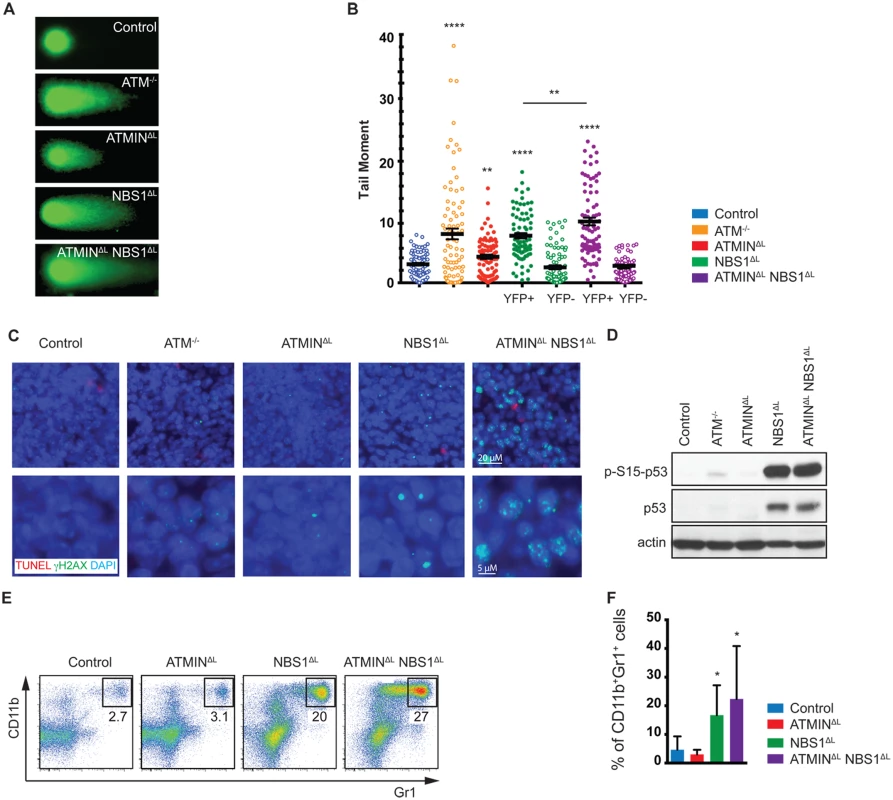 Loss of ATMIN and NBS1 in T cells leads to the accumulation of DNA damage.