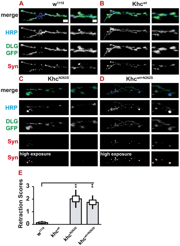 Light microscopic analysis of NMJ degeneration.