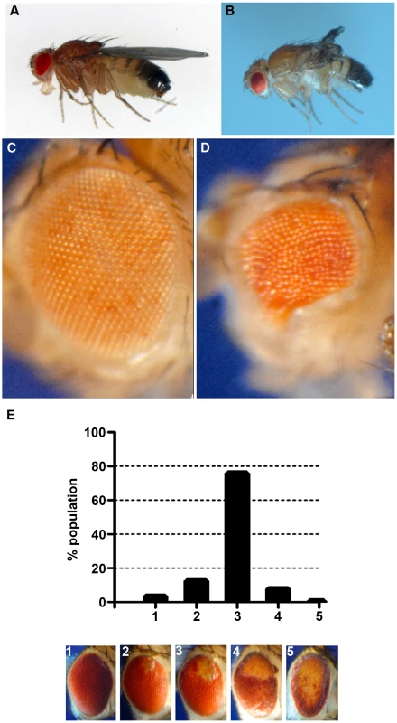 Phenotypes produced by <i>CryAB<sup>R120G</sup></i> expression.