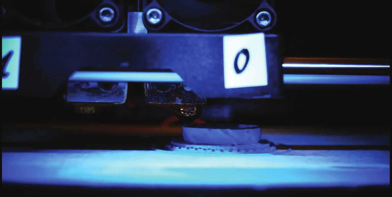 Detail 3D hlavy tlačiarne počas tlače modelu oka s vnútroočným nádorom