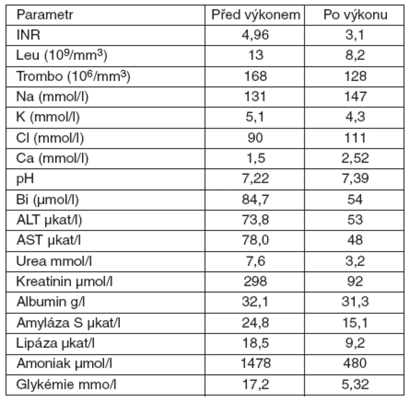 Dynamika laboratorních parametrů u 7leté pacientky s akutním jaterním selháním