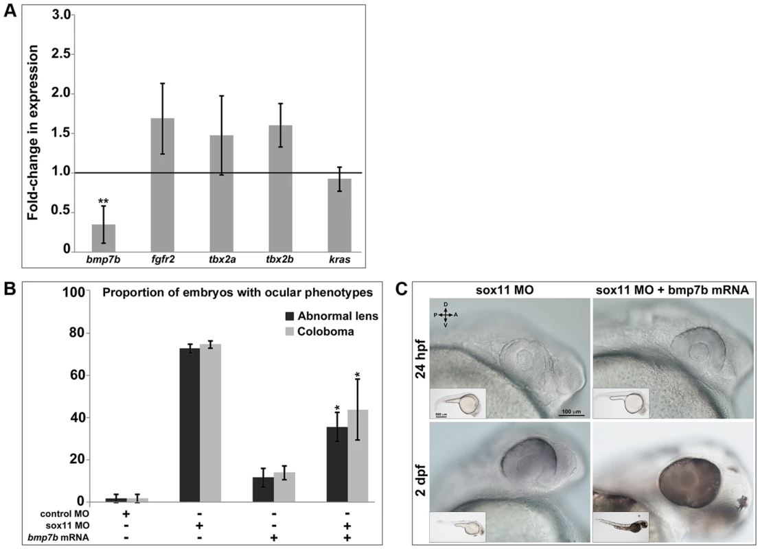<i>Bmp7b</i> expression is reduced in <i>sox11</i> morphants.