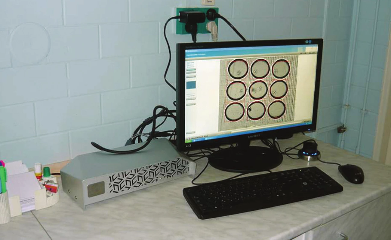 Primo Vision System