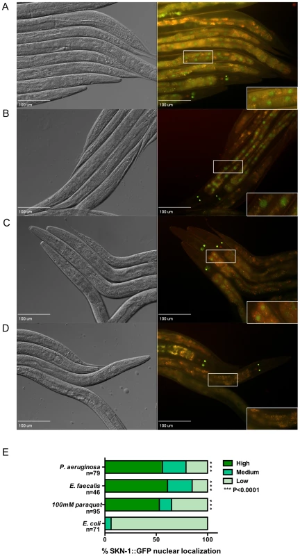 SKN-1 is localized to the nuclei of the intestinal cells in response to the pathogens.