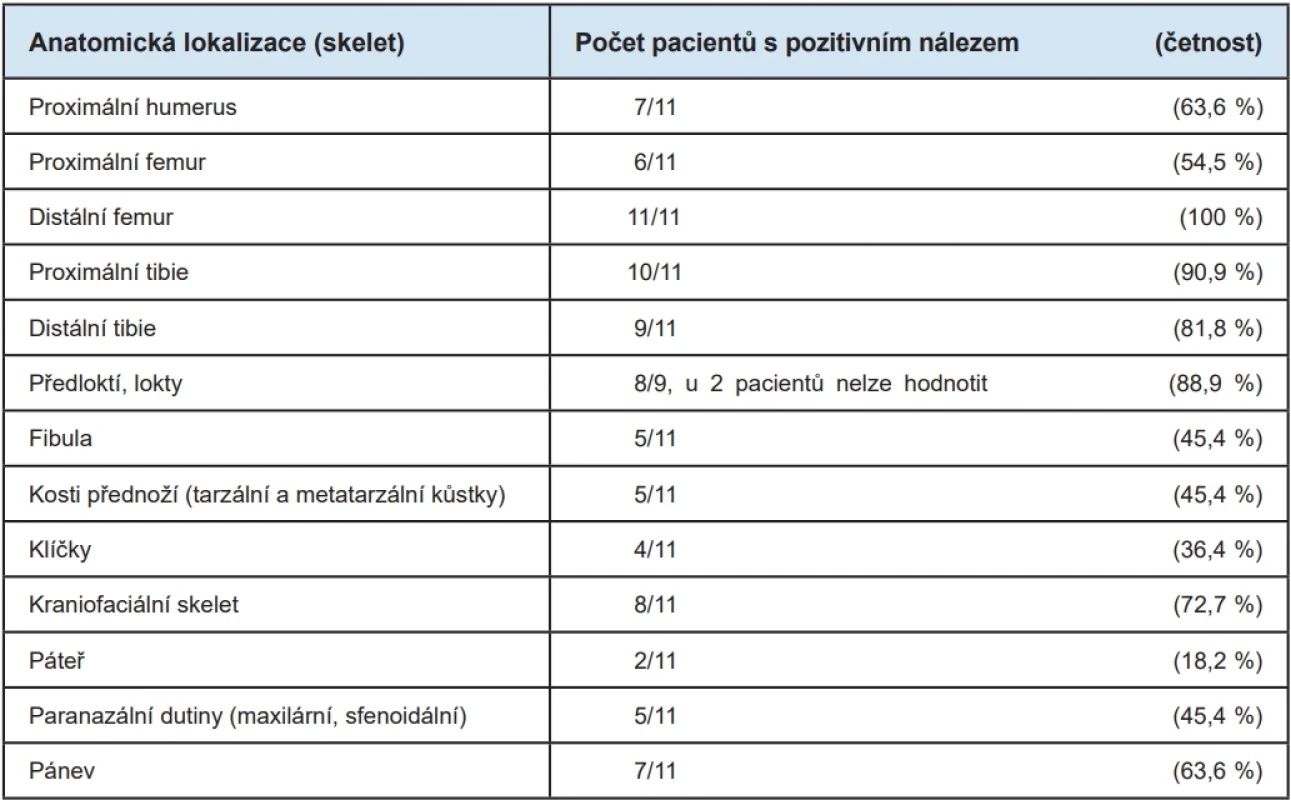 Místa s patologickou akumulací radiofarmaka.