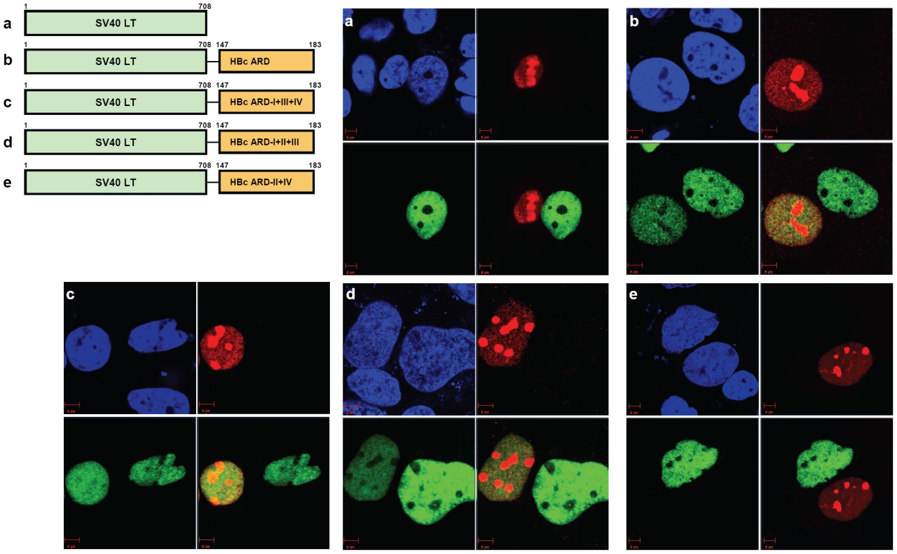 Homokaryon analysis revealed the existence of two independent NES-like signals in HBc ARD-II and ARD-IV.