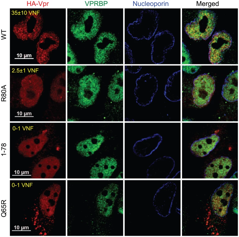 Analysis of the capacity of Vpr mutants to form nuclear foci.