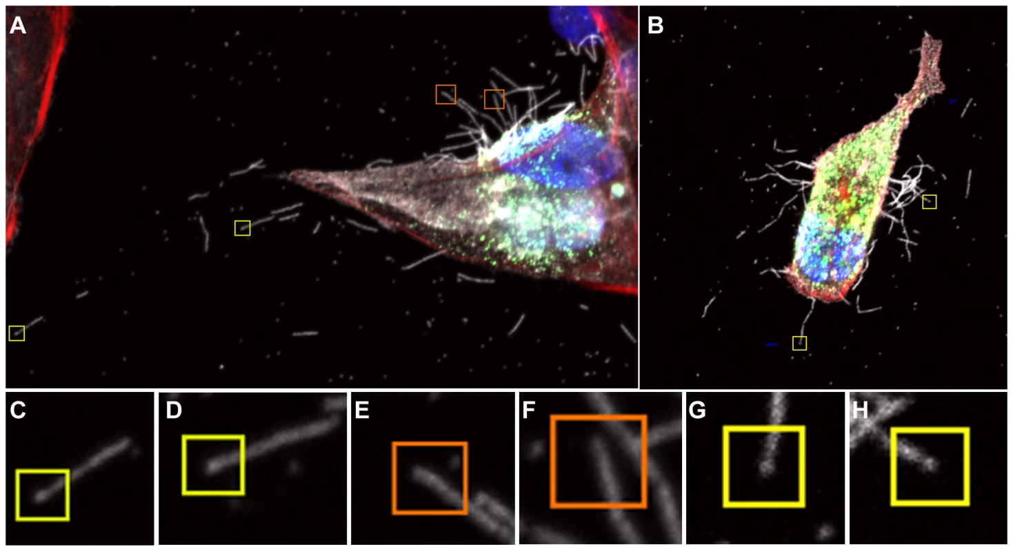 Close up view of filament formation at 8 hours (A) and 10 hours (B) post-infection showing the presence of bulbous termini at the end of some long filaments (C, D) and (G, H) indicated with a yellow box.